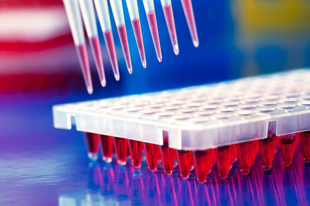 blood immunoassay test for parasites