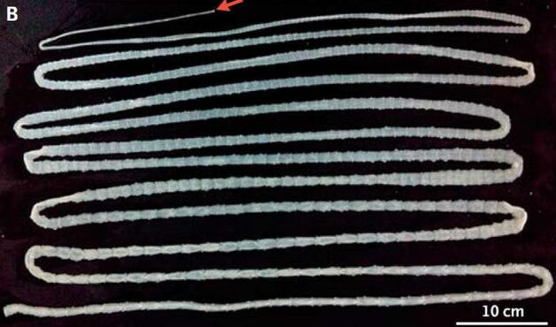 tapeworm from the human body