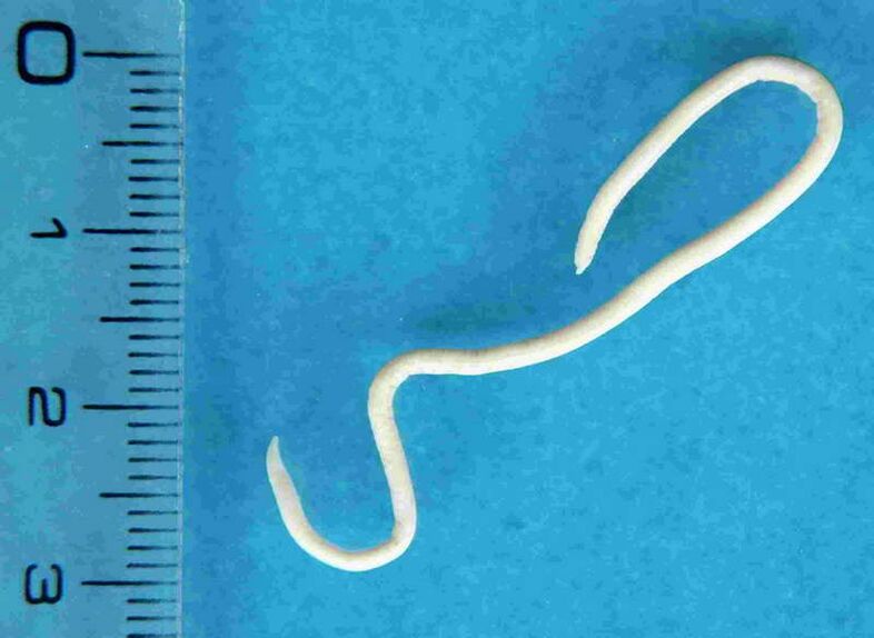 worm from the human body