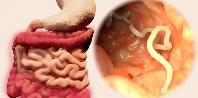 the worm is a human parasite